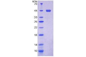 SDS-PAGE (SDS) image for TROVE Domain Family, Member 2 (TROVE2) (AA 16-376) protein (His tag) (ABIN6239487)