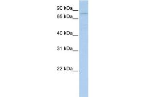 WB Suggested Anti-PYGB Antibody Titration:  0. (PYGB Antikörper  (N-Term))