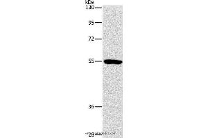 Western blot analysis of Mouse kidney tissue, using ANGPT2 Polyclonal Antibody at dilution of 1:800 (Angiopoietin 2 Antikörper)