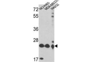 Western Blotting (WB) image for anti-Peroxiredoxin 3 (PRDX3) antibody (ABIN3001722)
