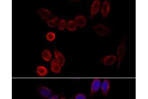 Immunofluorescence analysis of HeLa cells using CYP2A6 Polyclonal Antibody at dilution of 1:100 (40x lens). (CYP2A6 Antikörper)