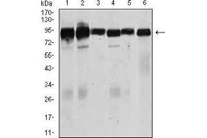 Western blot analysis using TGFBR3 mouse mAb against Jurkat (1), HeLa (2), MCF-7 (3), F9 (4), SK-N-SH (5), and NIH3T3 (6) cell lysate. (TGFBR3 Antikörper  (AA 147-328))