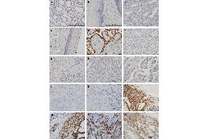 Immunohistochemical staining of various tissues with hematoxylin and HSD3B1 antibody under high magnification.