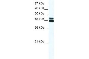 WB Suggested Anti-CHRNB2 Antibody Titration:  0. (CHRNB2 Antikörper  (N-Term))