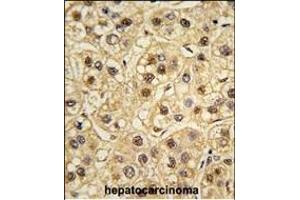 Formalin-fixed and paraffin-embedded human testis tissue reacted with YWHAZ Antibody (ABIN392783 and ABIN2842221) , which was peroxidase-conjugated to the secondary antibody, followed by DAB staining. (14-3-3 zeta Antikörper  (AA 211-239))