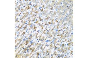 Immunohistochemistry of paraffin-embedded mouse stomach using CST1 antibody (ABIN5975714) at dilution of 1/100 (40x lens). (CST1 Antikörper)