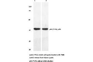 Western blot (WB) analyzes of p38 antibody (MAPK14 Antikörper)