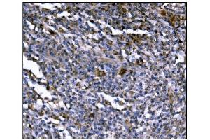IHC analysis of ERAP2 using anti-ERAP2 antibody (ABIN7599949). (ERAP2 Antikörper  (AA 13-960))