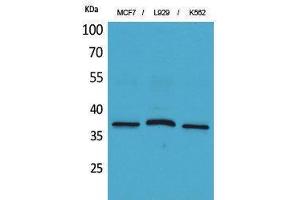 Western Blotting (WB) image for anti-CD79b Molecule, Immunoglobulin-Associated beta (CD79B) (Internal Region) antibody (ABIN3178286) (CD79b Antikörper  (Internal Region))