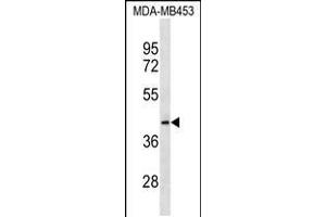 Western blot analysis in MDA-MB453 cell line lysates (35ug/lane). (MRPL46 Antikörper  (C-Term))