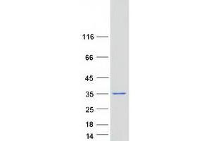 Western Blotting (WB) image for Coiled-Coil Domain Containing 43 (CCDC43) (Transcript Variant 1) protein (Myc-DYKDDDDK Tag) (ABIN2713299)