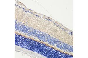 Immunohistochemistry of paraffin-embedded mouse retina using  antibody (ABIN6129704, ABIN6136903, ABIN6136905 and ABIN6216979) at dilution of 1:200 (40x lens). (Anoctamin 2 Antikörper  (AA 1-200))