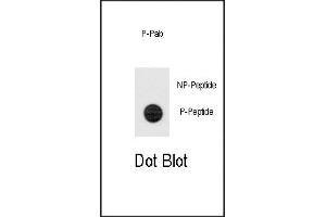 Dot blot analysis of anti-Phospho-TERT-p Antibody (ABIN389927 and ABIN2839747) on nitrocellulose membrane. (TERT Antikörper  (pSer1125))