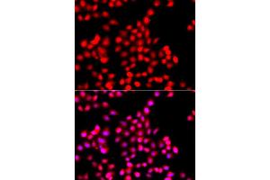 Immunofluorescence analysis of A549 cell using TTBK2 antibody. (TTBK2 Antikörper)