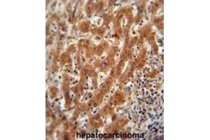 Immunohistochemistry (IHC) image for anti-Pyruvate Kinase (PK) antibody (ABIN2922768) (Pyruvate Kinase Antikörper)