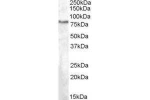 ABIN263220 (1µg/ml) staining of HepG2 lysate (35µg protein in RIPA buffer). (SEL1L Antikörper  (Internal Region))