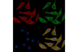 Occludin Mouse Monoclonal Antibody staining Hela cells by IF/ICC. (Occludin Antikörper  (Internal Region))