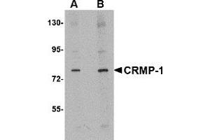 Western Blotting (WB) image for anti-Collapsin Response Mediator Protein 1 (CRMP1) (N-Term) antibody (ABIN1031328) (CRMP1 Antikörper  (N-Term))