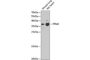 Western blot analysis of extracts of various cell lines using TPM4 Polyclonal Antibody at dilution of 1:1000. (Tropomyosin 4 Antikörper)