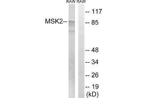 Western Blotting (WB) image for anti-Ribosomal Protein S6 Kinase A4 (RPS6KA4) (Thr568) antibody (ABIN1848240) (MSK2 Antikörper  (Thr568))