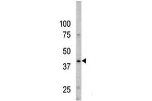 The anti-Phospho-Caspase 9- Pab (ABIN389526 and ABIN2839575) is used in Western blot to detect Phospho-Caspase 9- in Y79 cell line lysates.