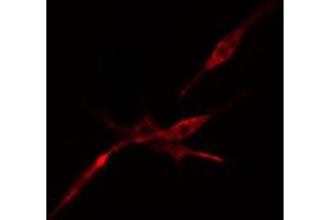 ABIN6274519 staining Hela cells by IF/ICC. (DCP1A Antikörper  (Internal Region))