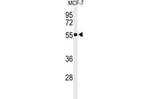 Western Blotting (WB) image for anti-Pre-mRNA Processing Factor 19 (PRPF19) antibody (ABIN3002151) (PRP19 Antikörper)