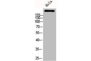 Western Blot analysis of HELA cells using Phospho-ACCα (S80) Polyclonal Antibody (Acetyl-CoA Carboxylase alpha Antikörper  (pSer80))