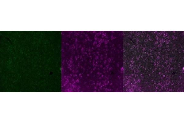 Tryptophan Hydroxylase 2 Antikörper