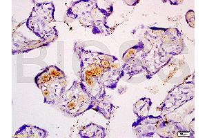 Formalin-fixed and paraffin embedded human placenta tissue with Anti-Fibulin 5 Polyclonal Antibody (ABIN728473), Unconjugated at 1:200, followed by conjugation to the secondary antibody and DAB staining (Fibulin 5 Antikörper  (AA 101-200))