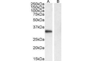 Western Blotting (WB) image for anti-Membrane-Spanning 4-Domains, Subfamily A, Member 1 (MS4A1) (C-Term) antibody (ABIN570905)
