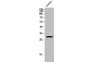 Western Blot analysis of JK cells using Med8 Polyclonal Antibody (MED8 Antikörper  (Internal Region))