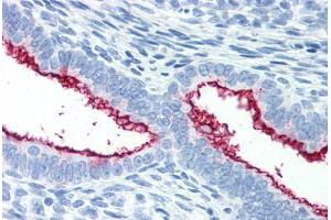 Human Uterus (formalin-fixed, paraffin-embedded) stained with MUC16 antibody ABIN351551 at 10 ug/ml followed by biotinylated anti-mouse IgG secondary antibody ABIN481714, alkaline phosphatase-streptavidin and chromogen. (MUC16 Antikörper)