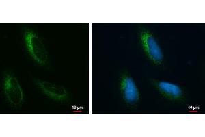 ICC/IF Image Grp78 antibody [N2C1], Internal detects Grp78 protein at endoplasmic reticulum by immunofluorescent analysis. (GRP78 Antikörper  (Internal Region))