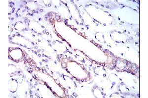 Immunohistochemical analysis of paraffin-embedded kidney tissues using RPL18A mouse mAb with DAB staining. (RPL18A Antikörper  (AA 50-176))