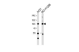 Western blot analysis of lysates from A431,NCI- cell line (from left to right),using FA13A (Cleaved-Gly39) Antibody (ABIN486738 and ABIN1536119). (FA13A (Cleaved-Gly39) Antikörper)