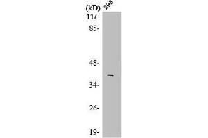 Western Blot analysis of 293 cells using LMO4 Polyclonal Antibody (LMO4 Antikörper  (C-Term))