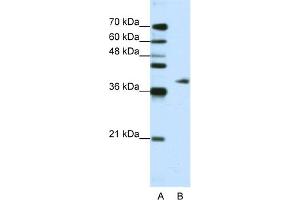 WB Suggested Anti-ADAT1 Antibody Titration:  1. (ADAT1 Antikörper  (C-Term))
