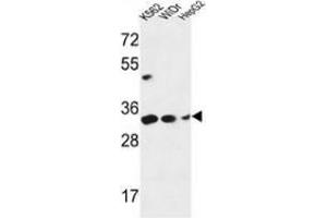 Western blot analysis of PYCR1 (arrow) in K562, WiDr, HepG2 cell line lysates (35ug/lane) using PYCR1  Antibody (C-term). (PYCR1 Antikörper  (C-Term))