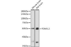Western blot analysis of extracts of various cell lines, using TOM1L2 antibody (ABIN7270733) at 1:1000 dilution. (TOM1L2 Antikörper)