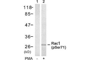 Western blot analysis of extracts from 293 cells untreated(lane 1) or treated with PMA(lane 2) using Rac1(Phospho-Ser71) Antibody. (RAC1 Antikörper  (pSer71))