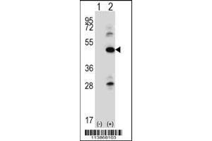 Western blot analysis of ILK using rabbit polyclonal ILK Antibody (pS246) using 293 cell lysates (2 ug/lane) either nontransfected (Lane 1) or transiently transfected (Lane 2) with the ILK gene. (ILK Antikörper  (AA 225-253))