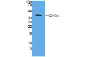 Western blot analysis of recombinant Mouse TFF3.