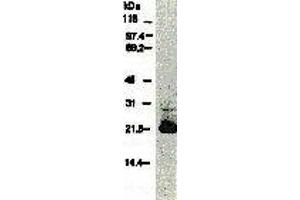 Western Blotting (WB) image for anti-Hepatitis C Virus Core Protein (HCV C) (AA 13-124), (AA 369-704) antibody (Biotin) (ABIN2451996)