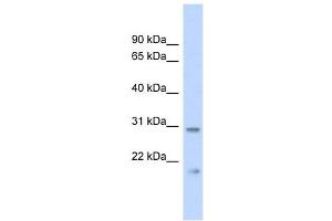 C1orf96 antibody used at 1 ug/ml to detect target protein. (CCSAP Antikörper  (Middle Region))
