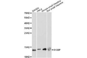 Western blot analysis of extracts of various cell lines, using S100P antibody. (S100P Antikörper)