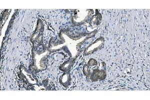 IHC analysis of EEF2/Elongation factor 2 using anti-EEF2/Elongation factor 2 antibody (ABIN7603142).
