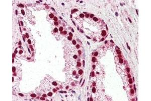 IHC staining of FFPE human prostate tissue with IRF6 antibody at 2. (IRF6 Antikörper)