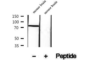 Western blot analysis of extracts of mouse brain tissue, using Phospho-Tau (Ser199) Antibody.
