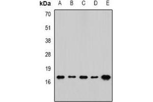 Western blot analysis of RPLP1 expression in SW480 (A), mouse spleen (B), mouse brain (C), rat lung (D), rat liver (E) whole cell lysates.